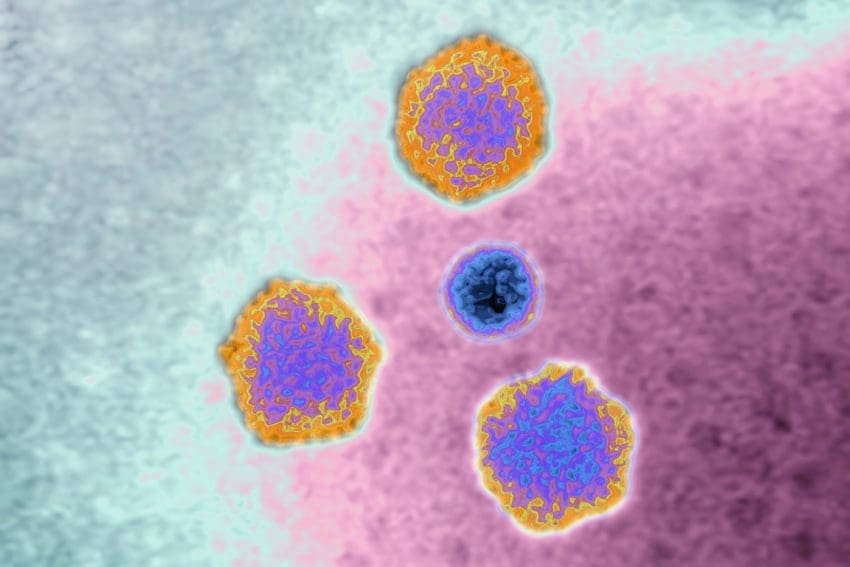 Adenovírus pode ser a causa da hepatite nas crianças