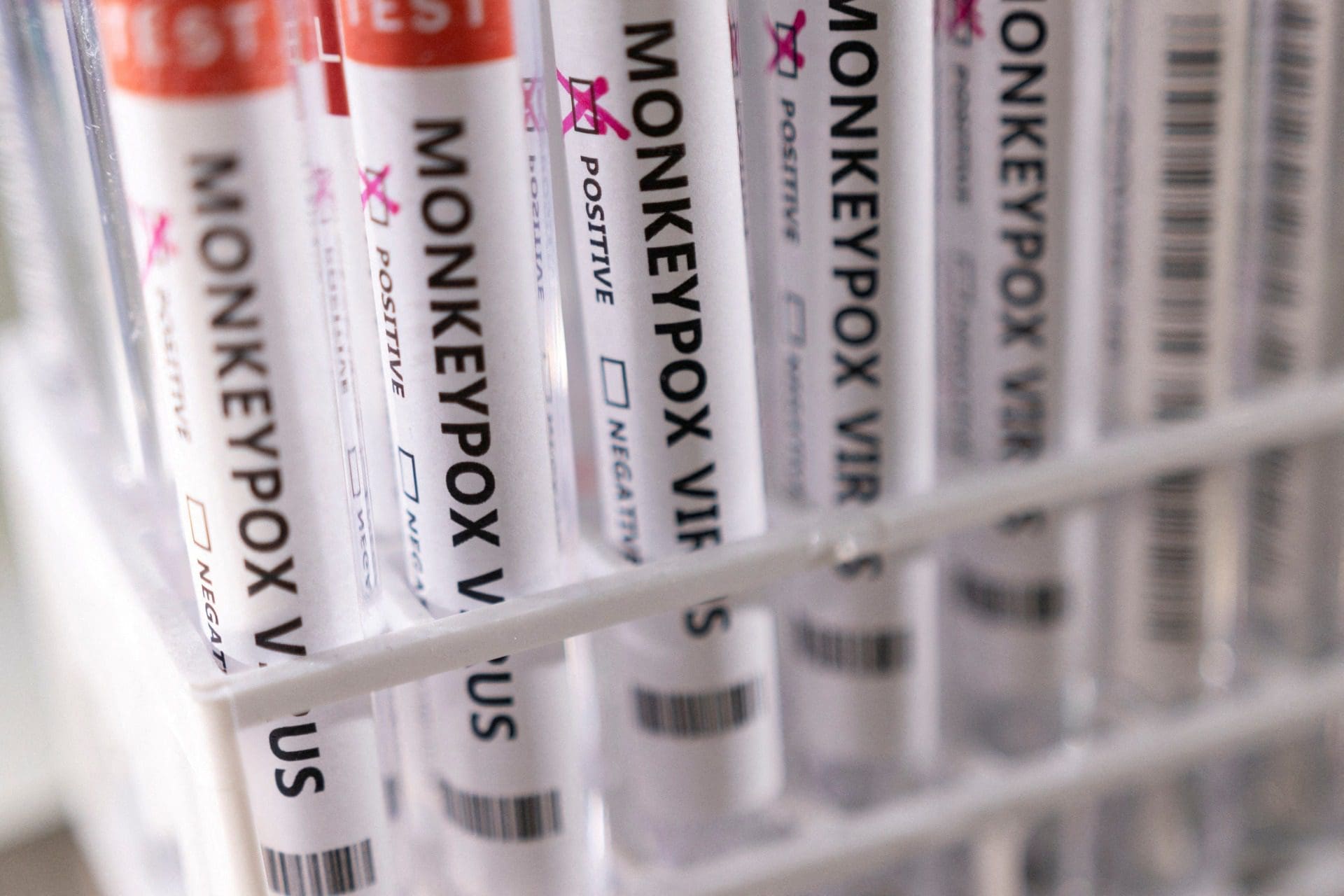 Monkeypox: Madeira registou primeiro caso confirmado de infeção