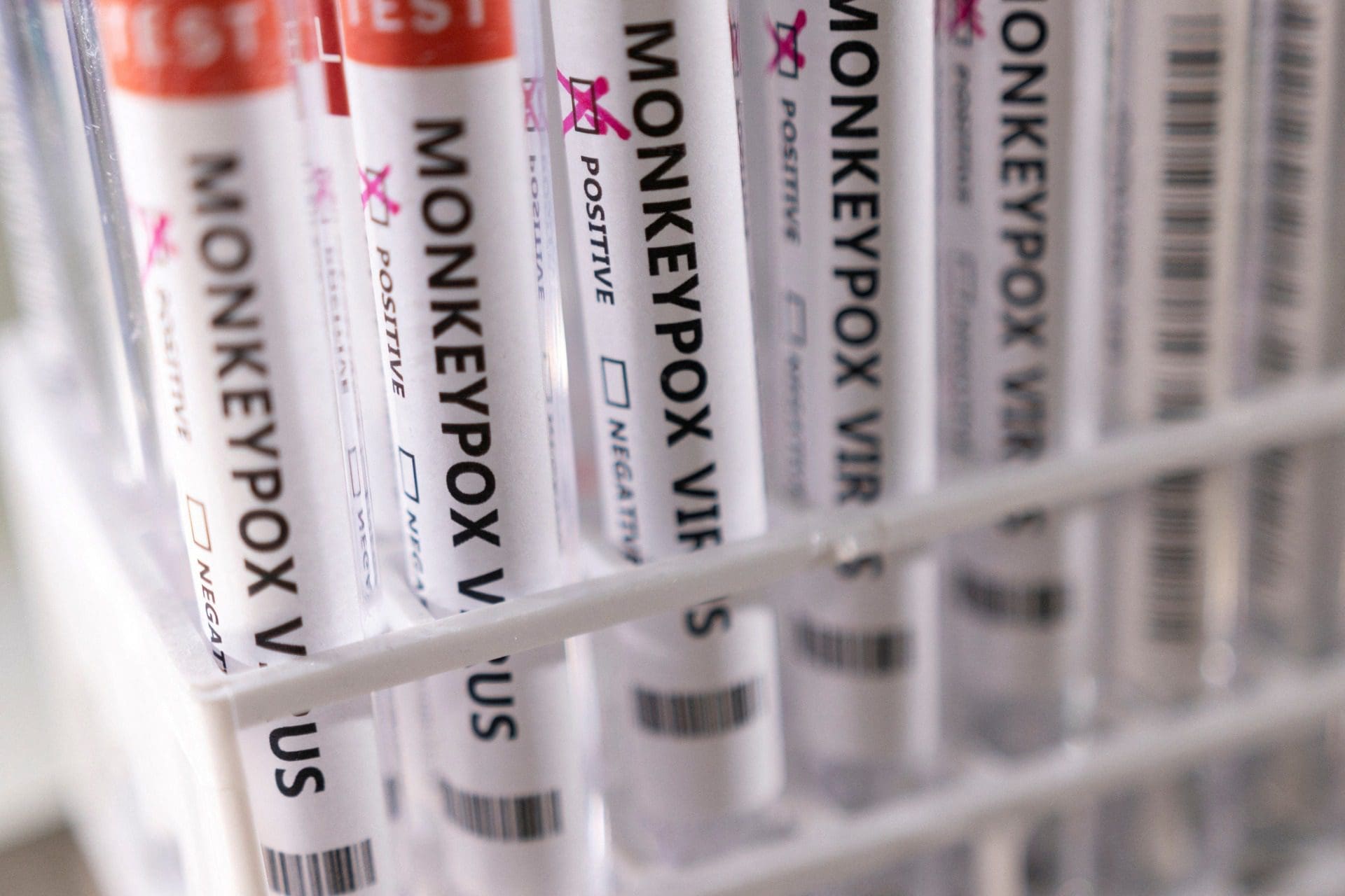 Monkeypox: Contágios aumentaram 20% na última semana em todo o mundo